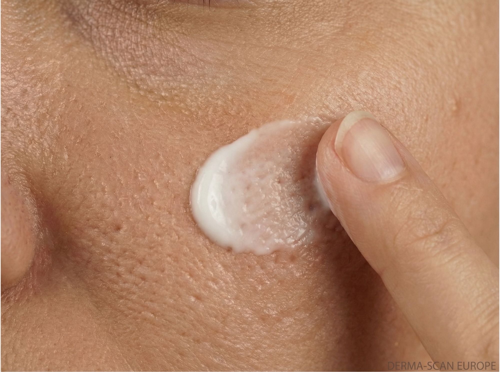 Close-up van wang met crème aangebracht op huid met zichtbare poriën voor een egalere huidstructuur